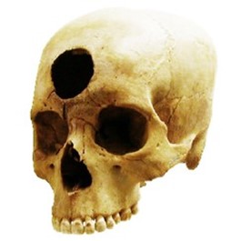 Human skull with large hole in forehead